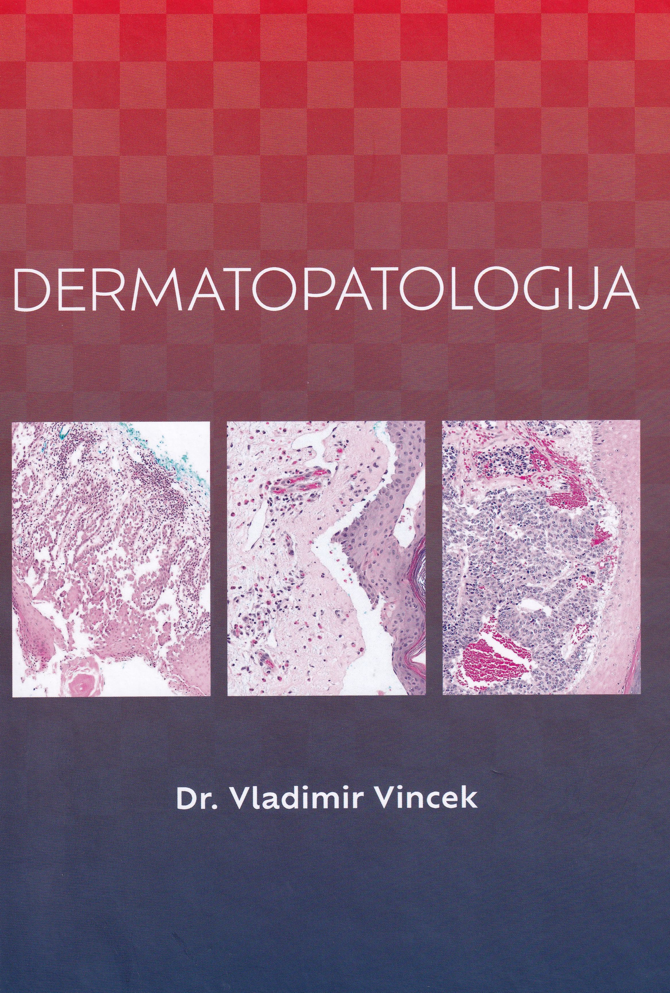 Dermatopatologija / Vladimir Vincek