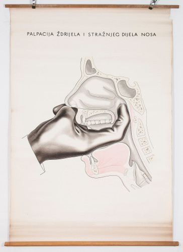 Digitalna palpacija nosnoga ždrijela (epifarinksa)