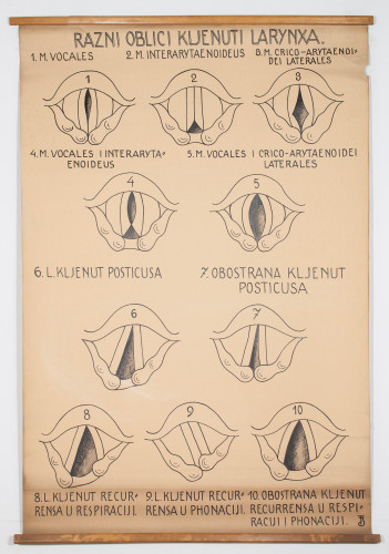 Razni oblici kljenuti glasiljki