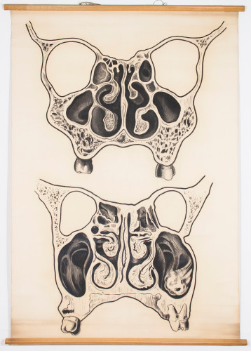 Dva koronalna presjeka glave u području paranazalnih šupljina