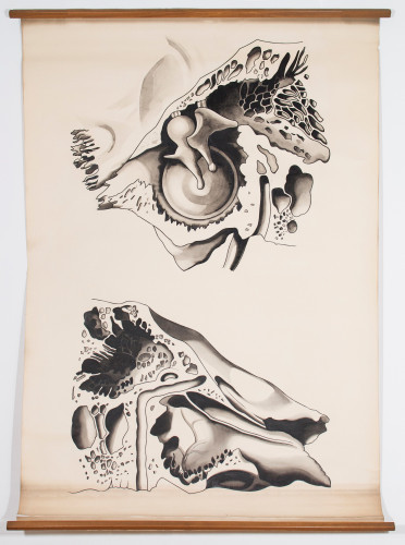 Lateralni i medijalni zid kavuma timpani