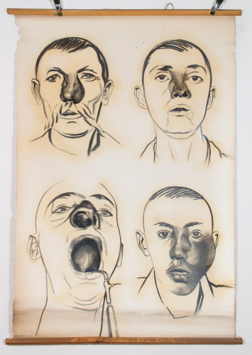 Četiri prikaza nosnih bolesti