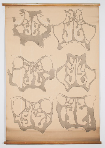 Crtež vertikalnih (koronalnih) presjeka kroz nos i paranazalne šupljine