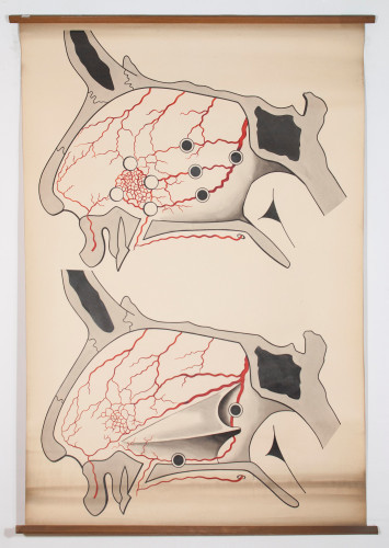 Izvori nosnoga krvarenja po Escatu