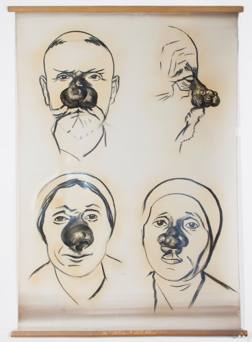 Četiri slučaja tumora nosa