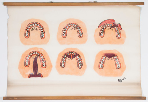 Razne vrste rascjepa čeljusti i nepca