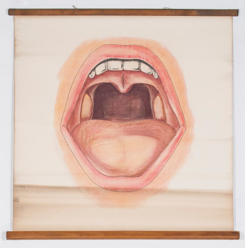 Normalan izgled ždrijela pri faringoskopiji