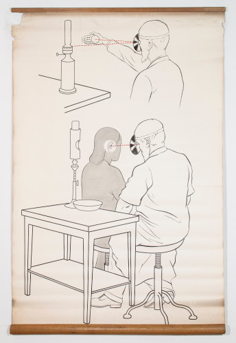 Tumač uporabe čeonog zrcala pri otorinolaringološkom pregledu