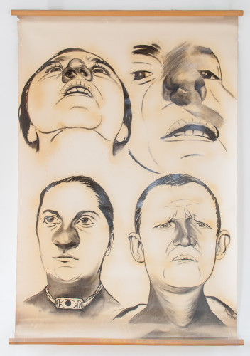 Četiri rinološka slučaja (kožne bolesti vanjskoga nosa)