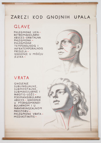 Početni kirurški rezovi pri gnojnim upalama raznih područja glave i vrata