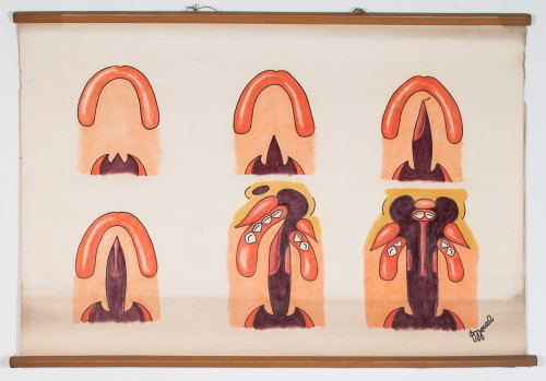 Razne vrste rascjepa čeljusti i nepca